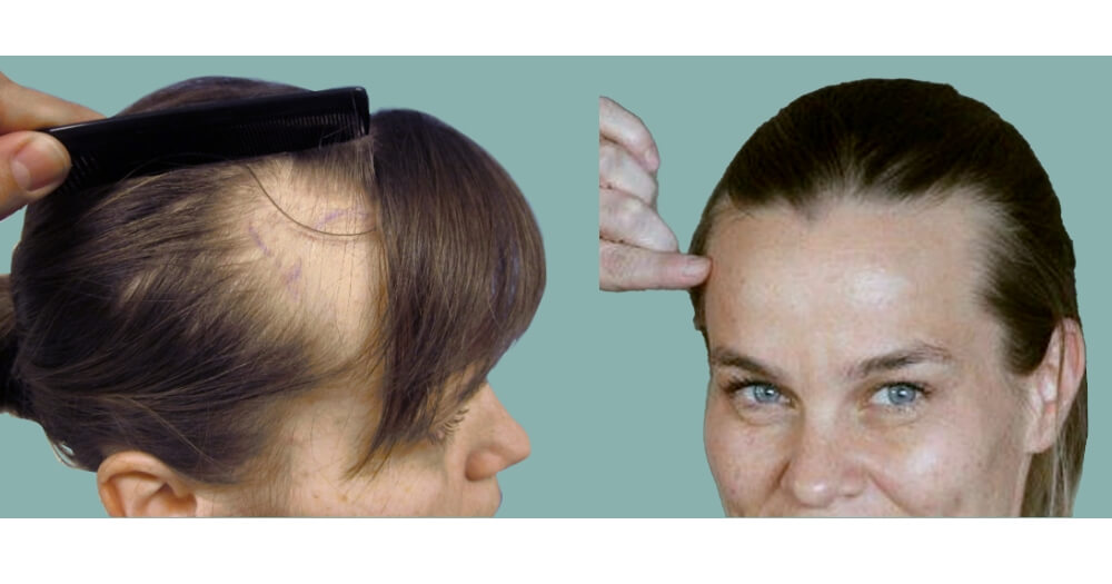 Bild zeigt vorher nachher behandlung