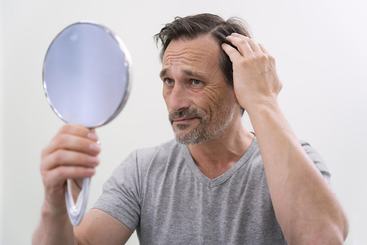 Bild zeigt Mann mit Haarverlust