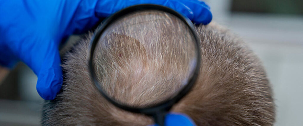 Bild zeigt Lupe auf Haaransatz