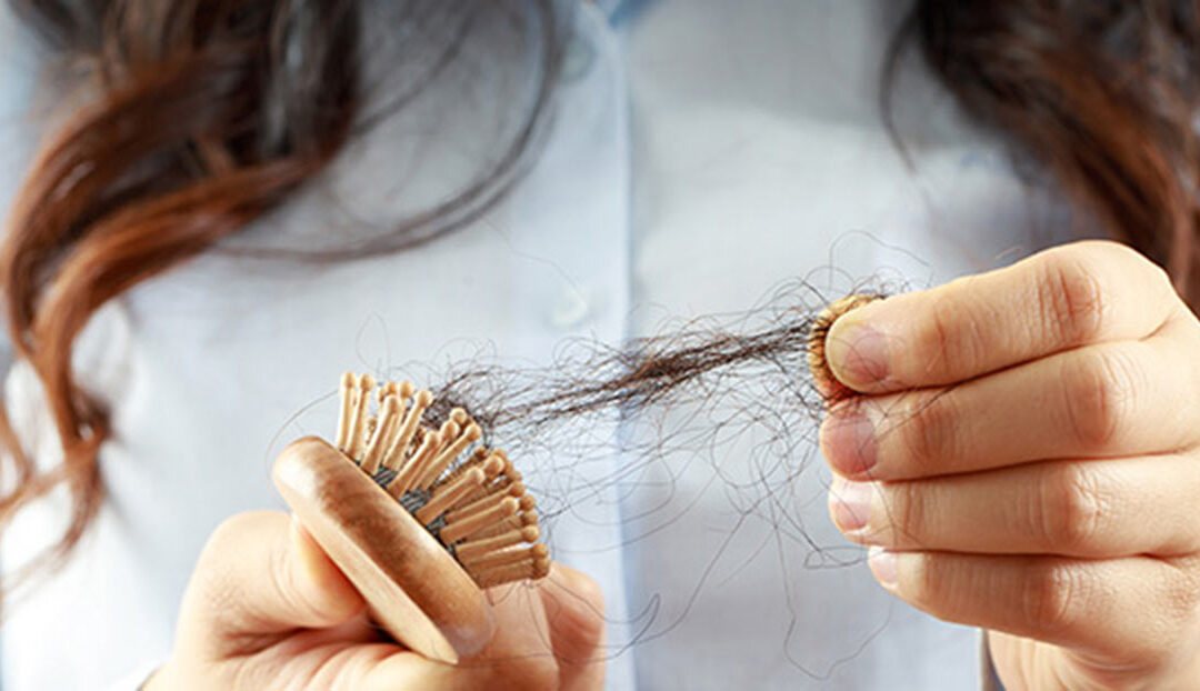 Umgang der Österreicherinnen und Österreicher mit Haarausfall