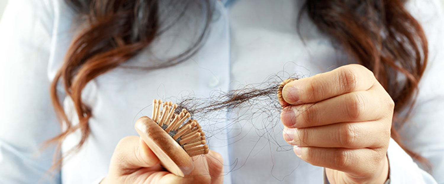 Bild zeigt Bürste mit Haarausfall
