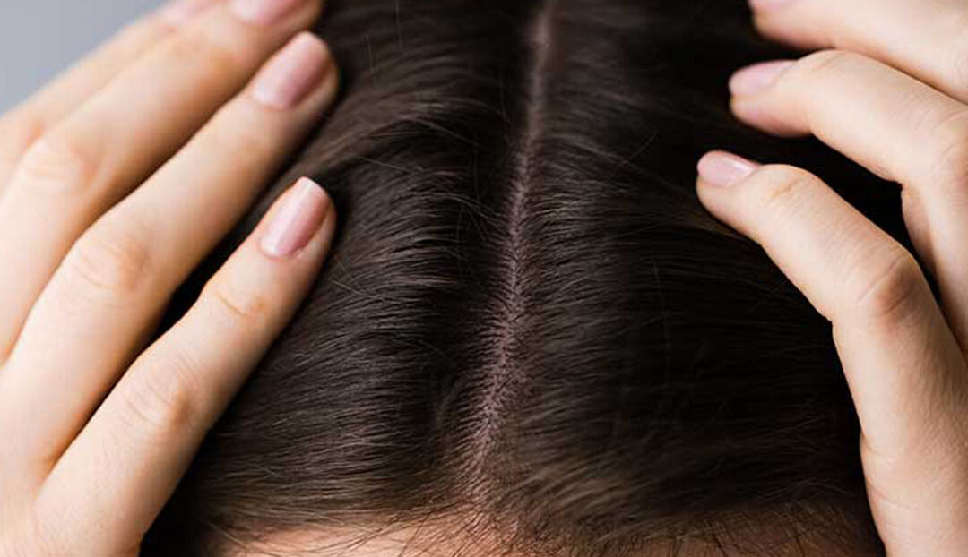 Haarausfall und seine Ursachen