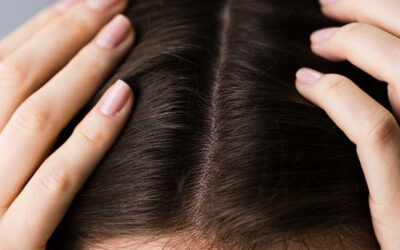 Haarausfall und seine Ursachen