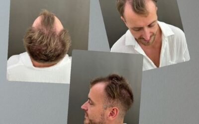 Julienco – vollere Haarpracht statt kaschieren