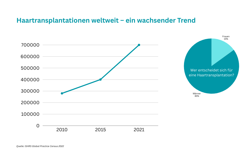 Statistische Grafik zum Trendgeschehen bei der Haartransplantation